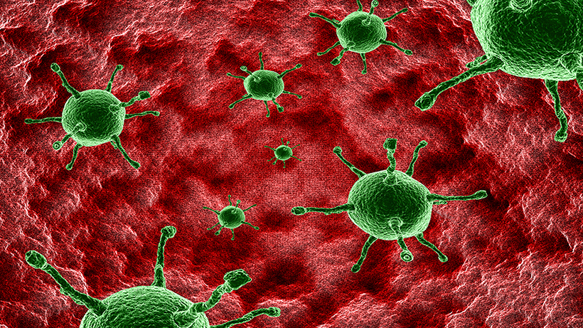 Carcinoma Ductal In Situ